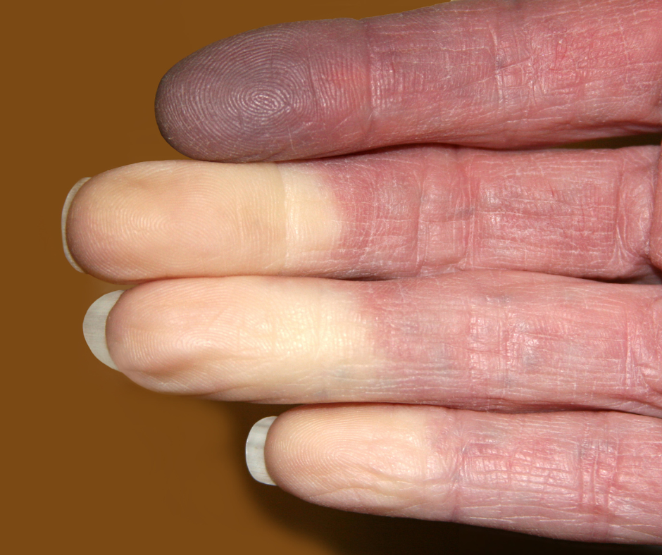 white fingertips